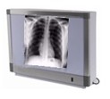 X-Ray viewing boxes with fluro tubes or led.